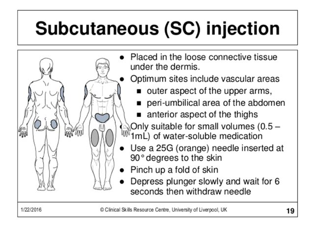 Subcutaneous Injection Mastering Subcutaneous Injections A